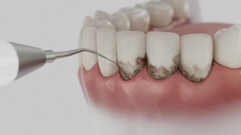 Trusted Dental Implants service in Caney, KS - Dentist Open Now